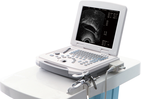 超導可視無痛人流機,可視無痛人流機,可視人流機,可視人流b超機,