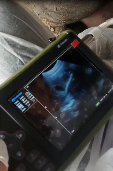 醫(yī)用b超,動(dòng)物b超,醫(yī)用b超機(jī),動(dòng)物b超機(jī),彩超機(jī)