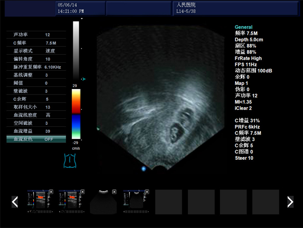 無痛人流機,無痛人流做的時機
